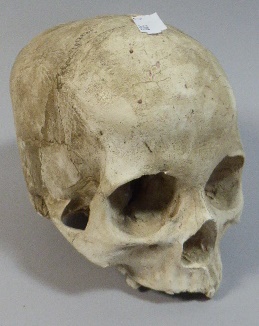 A Plaster Cast of A Human Skull,