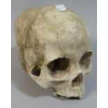 A Plaster Cast of A Human Skull,