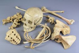 A Human Skull and Part Skeleton