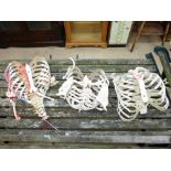 GUYS HOSPITAL TRAINING SKELETON PARTS, RIBS