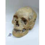 VICTORIAN SKULL, ORIGINALLY FROM LONDON MEDICAL SCHOOL, DONATED TO LONDON ART COLLEGE & USED BY