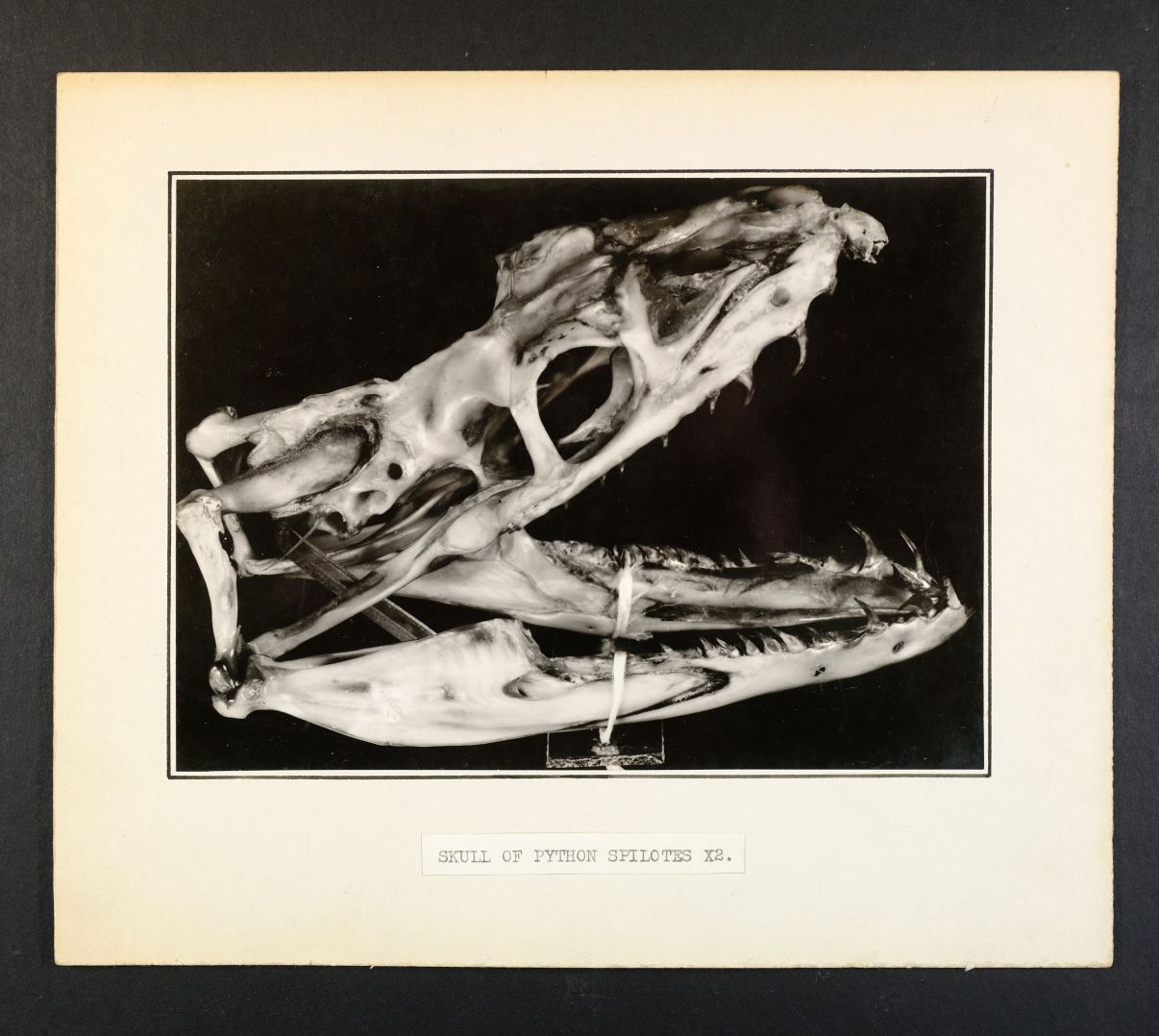 *Army Medical Museum, USA. A surgical photograph of a bullet hole through a human spine, Fort - Image 3 of 6