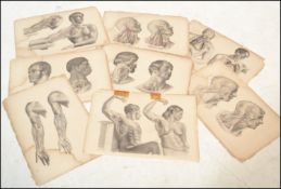 Surgical Anatomy Printed by M&N Hanhart - A collection of 19th Century 30x large coloured lithograph