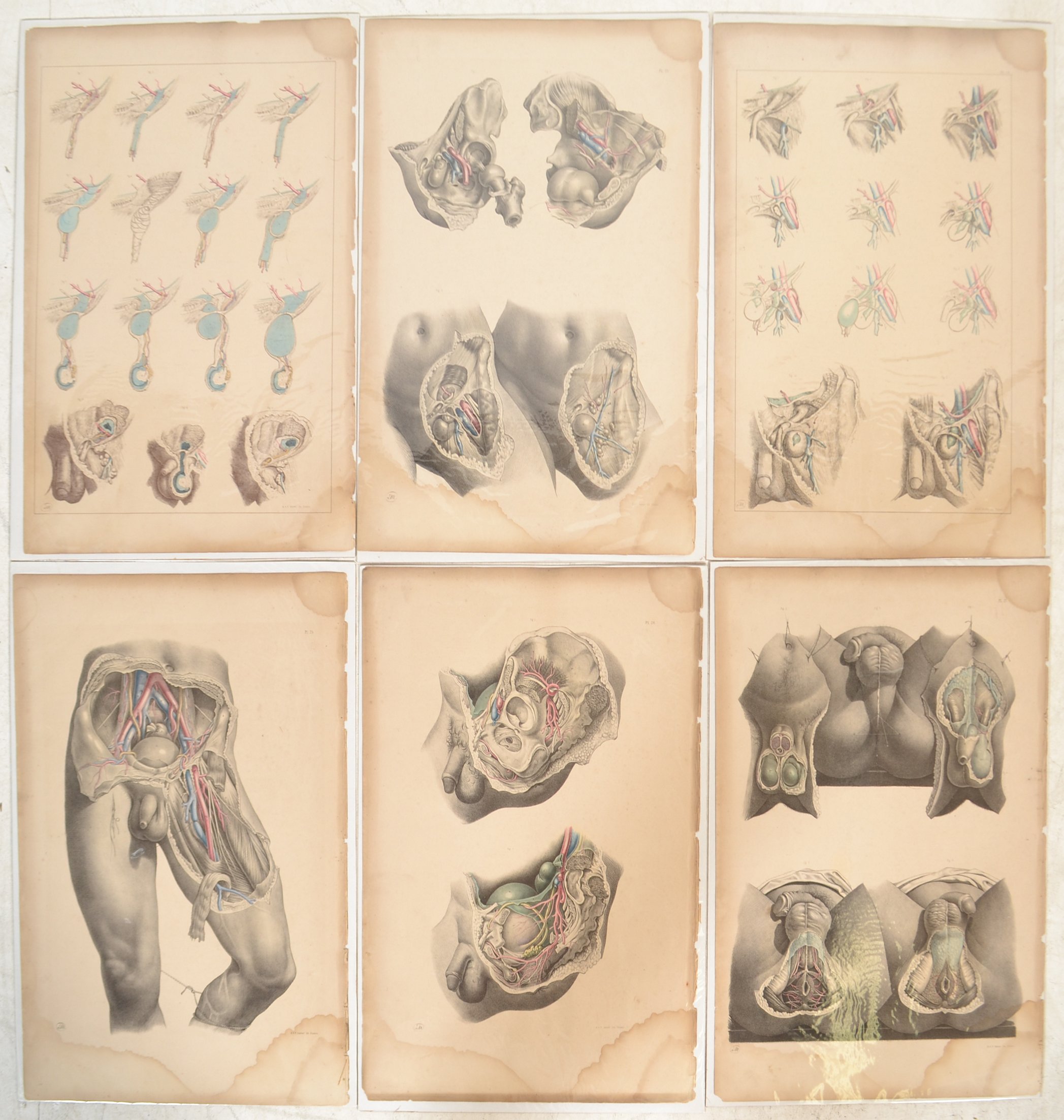 JOSEPH MACLISE ANATOMICAL SURGICAL AND MEDICAL LITHOGRAPHS PLATES - Image 6 of 8