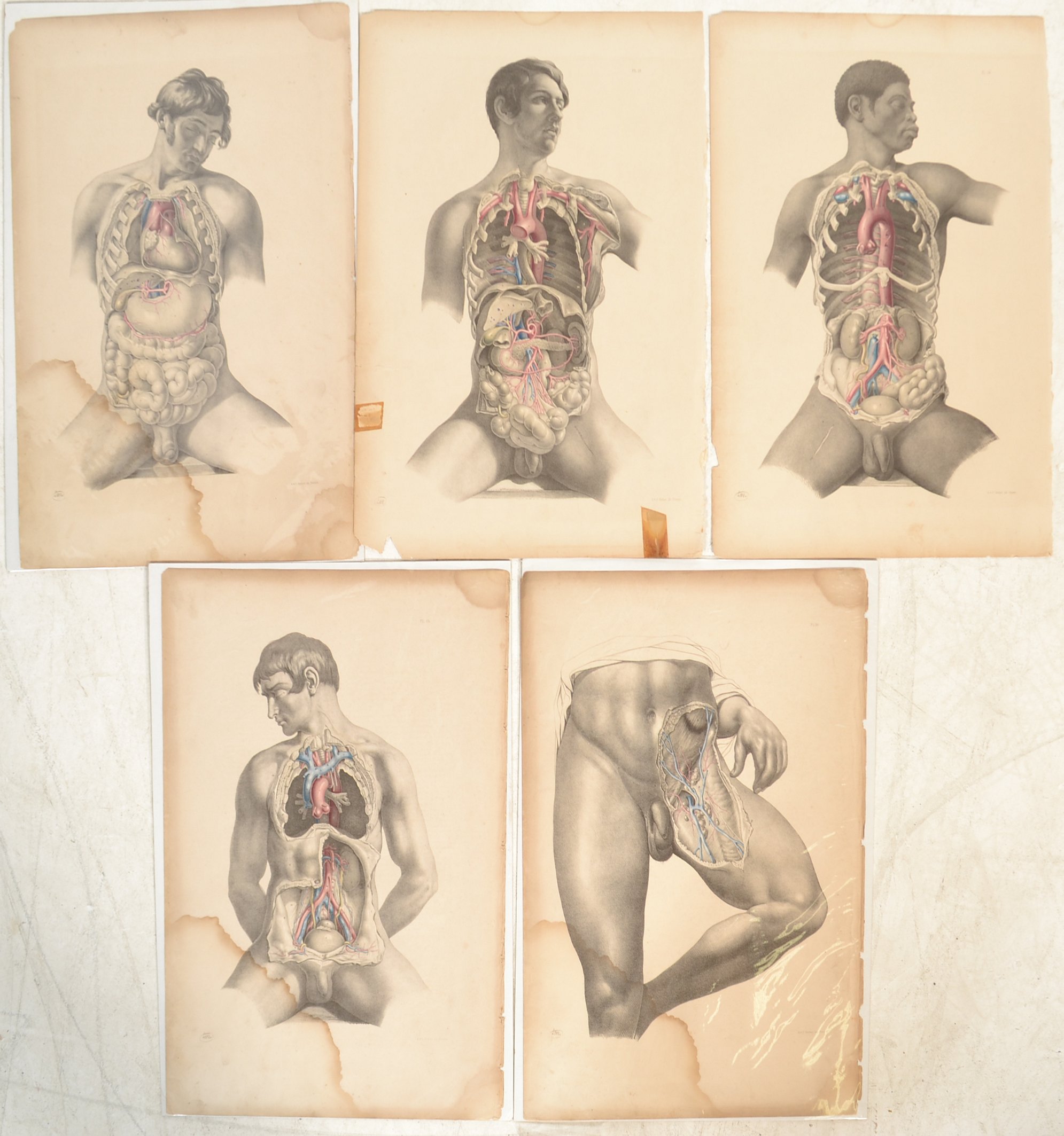 JOSEPH MACLISE ANATOMICAL SURGICAL AND MEDICAL LITHOGRAPHS PLATES - Image 4 of 8