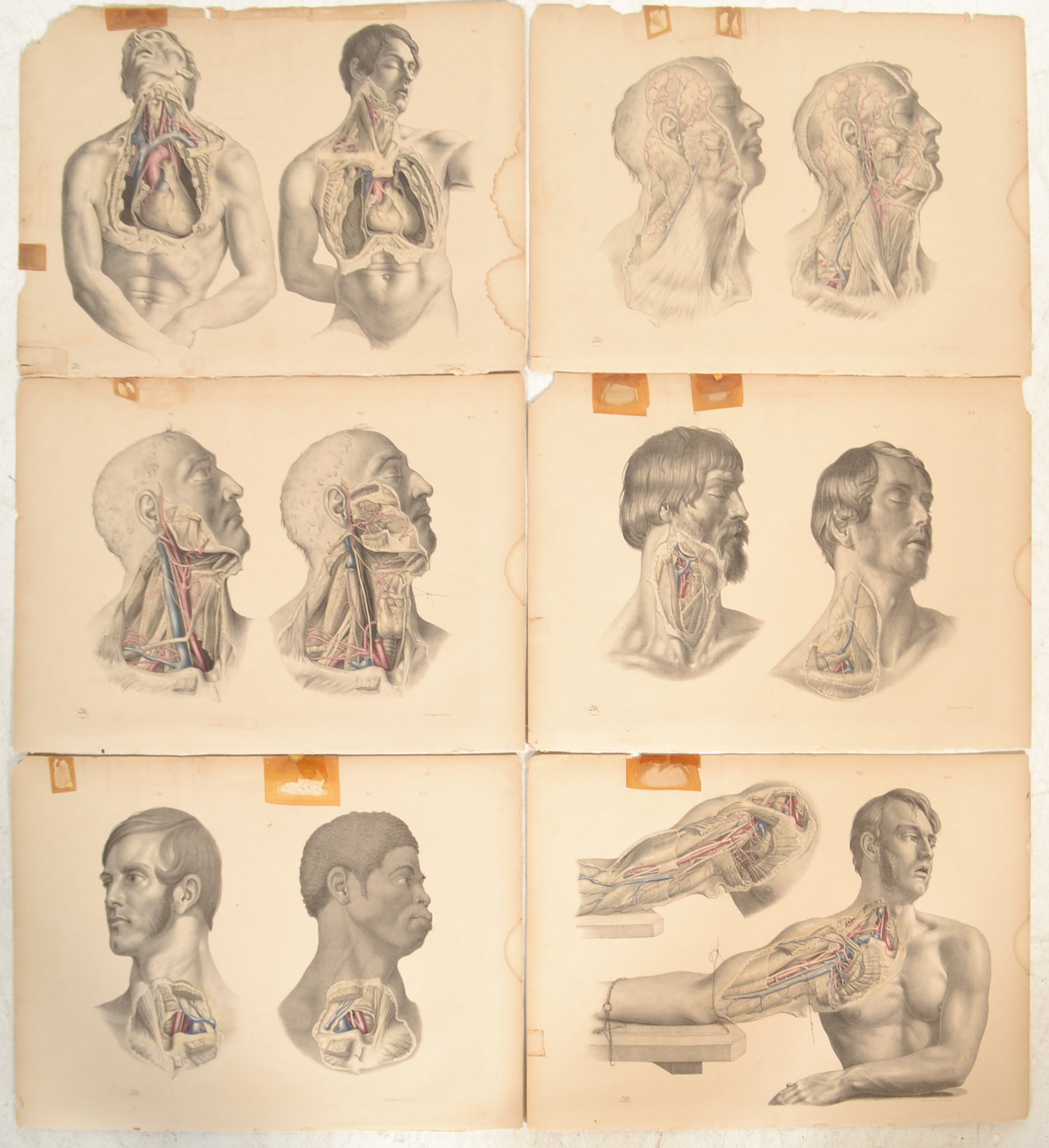 JOSEPH MACLISE ANATOMICAL SURGICAL AND MEDICAL LITHOGRAPHS PLATES - Image 2 of 8