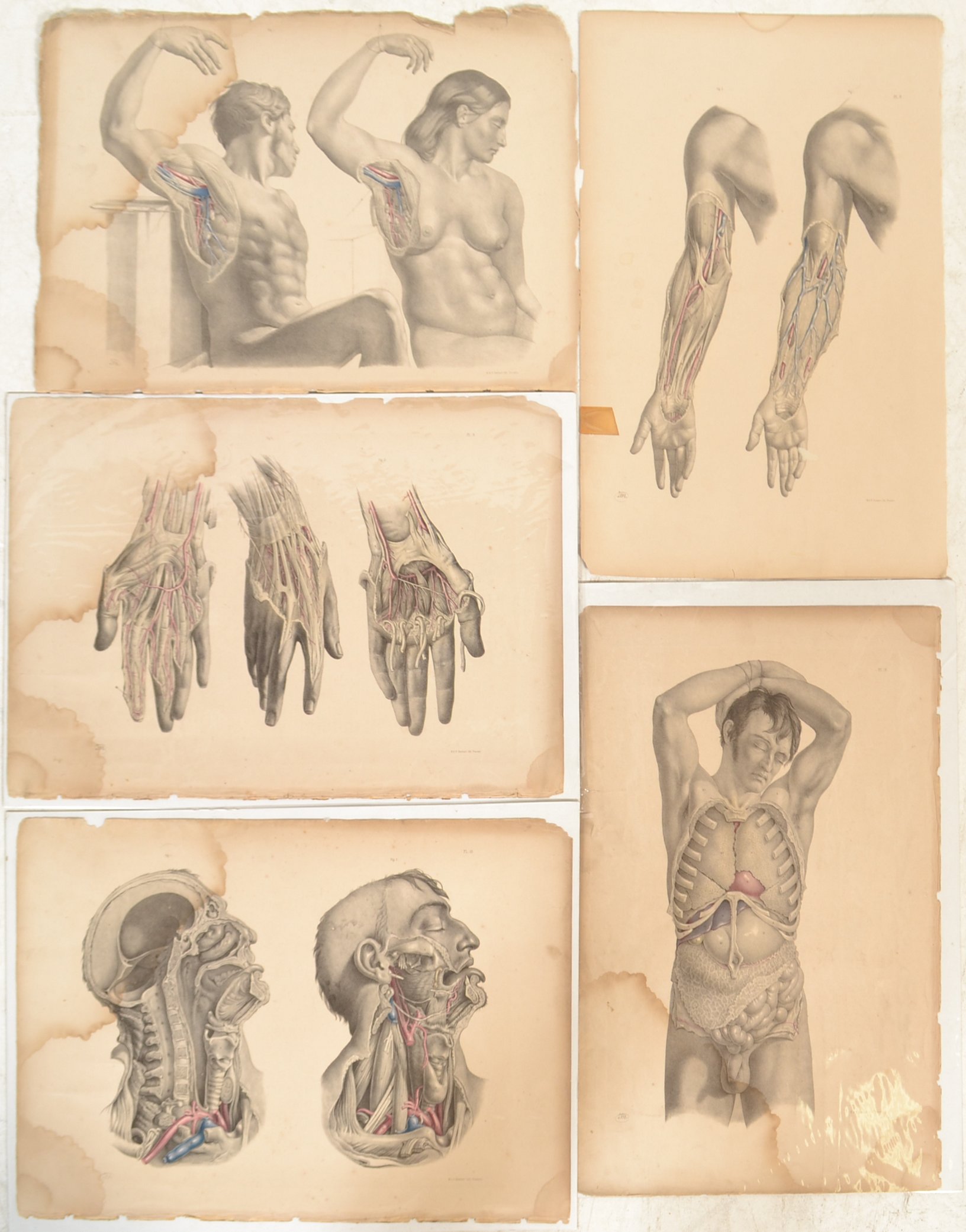 JOSEPH MACLISE ANATOMICAL SURGICAL AND MEDICAL LITHOGRAPHS PLATES - Image 3 of 8