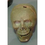 A cast skull with hinged jaw,