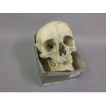 Antique human skull CONDITION REPORT It looks like an adult,