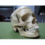 A Human Skull, with removable top and sprung jaw.