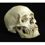 A RARE BRONZE AGE HUMAN SKULL With partially mineralized teeth and evidence of a healed head