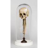 A 19TH CENTURY HUMAN SKULL AND SPINE UNDER LATER GLASS DOME. (h 63.5cm x w 27cm x d 27cm)