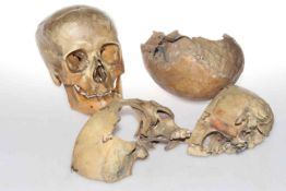Two human skulls
