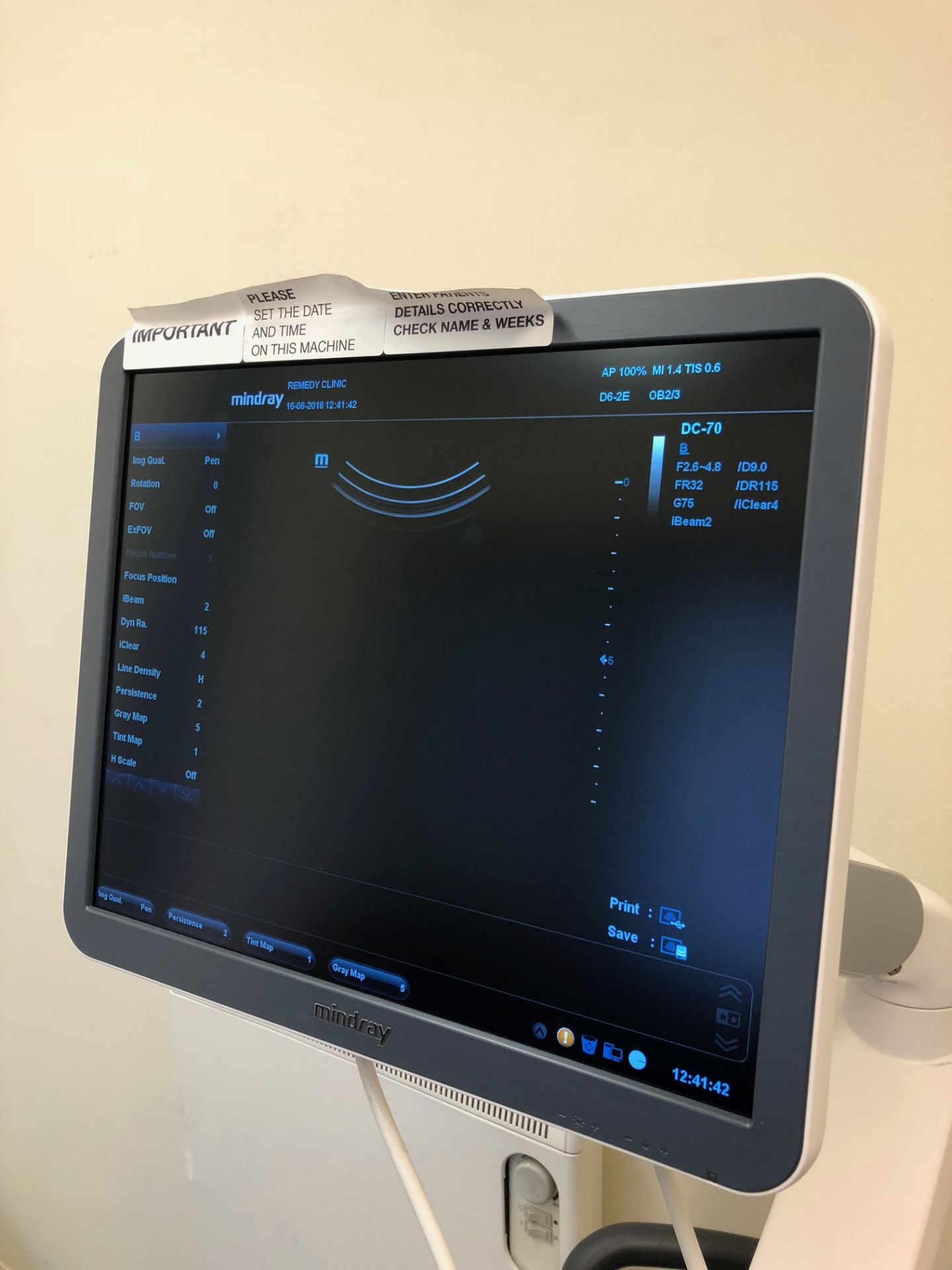 Mindray, DC-70 Ultrasound Complete with 4 Transducers - 4D system - Image 4 of 13