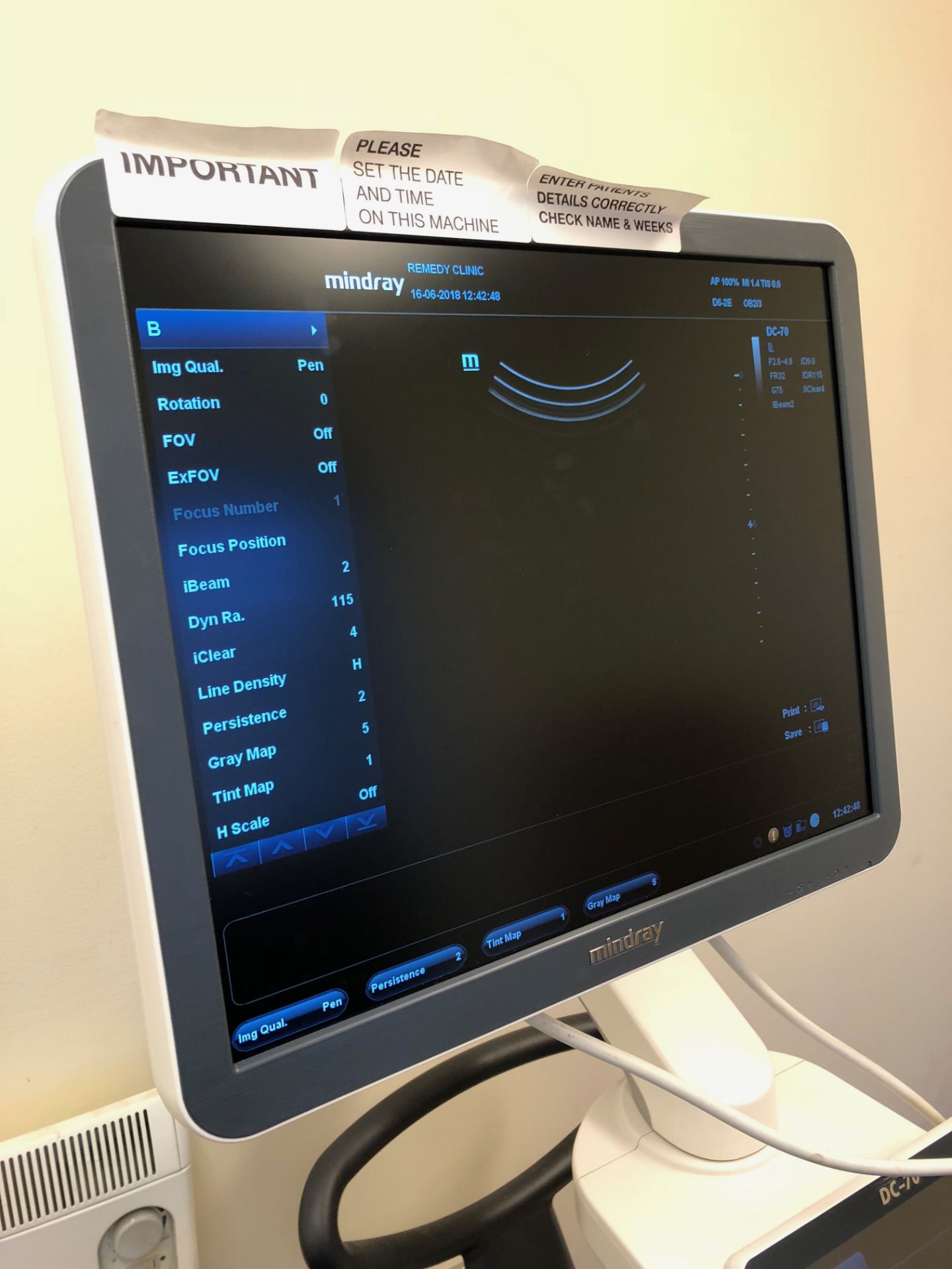 Mindray, DC-70 Ultrasound Complete with 4 Transducers - 4D system - Image 8 of 13