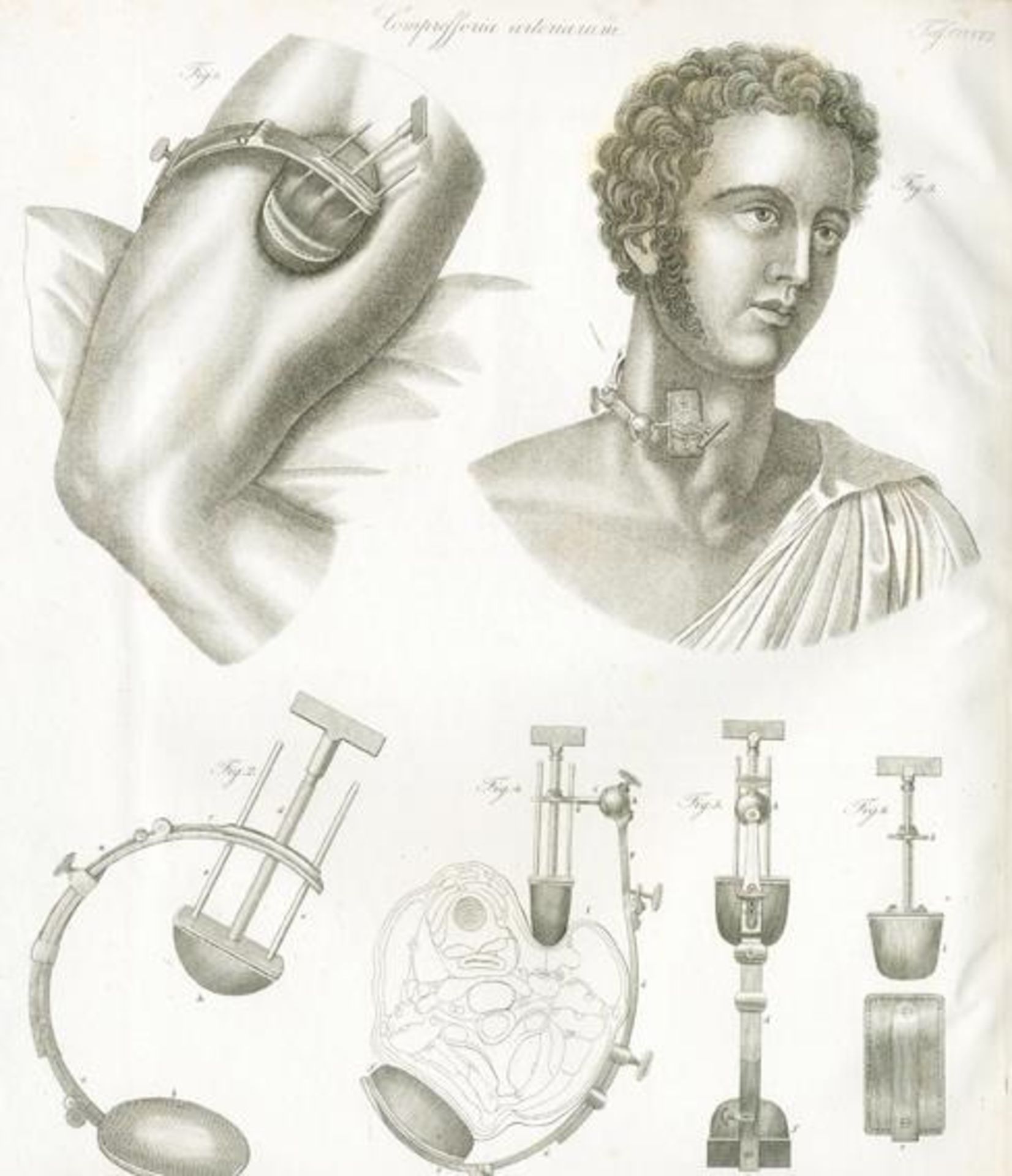 (Froriep,L.F.).Chirurgische Kupfertafeln. Eine auserlesene Sammlung der nöthigsten Abbildungen von