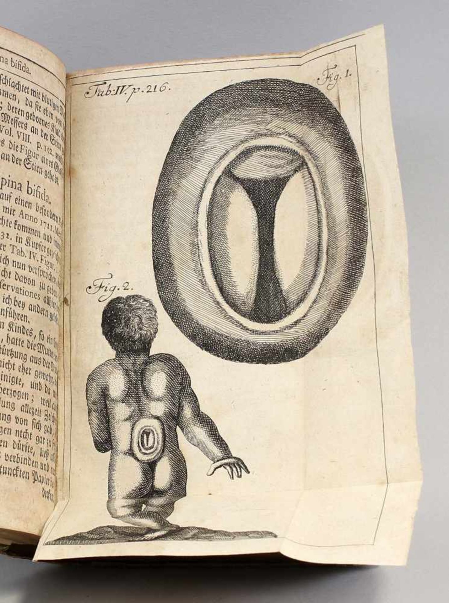Storch, Kinderkrankheiten v. 1750 Pelargus Pädiatrie .von Dr. Johann Storch (1681-1751, deutscher - Bild 3 aus 3