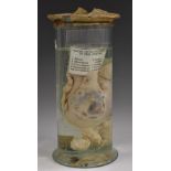 Natural History - a wet jar specimen, of a sheep's womb and two foetuses,
