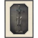 Daguerreotypes: SkeletonPhotographer: Bernd Renard (attributed to). Skeleton. 1980s. Modern half-