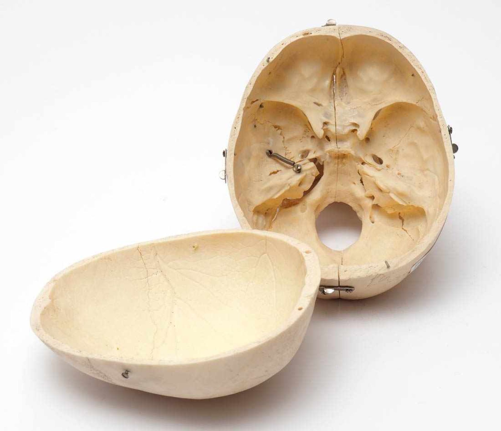 SchädelMedizinisches Studienpräparat, mehrfach geteilt. Durchm. ca. 20cm. - Bild 7 aus 7