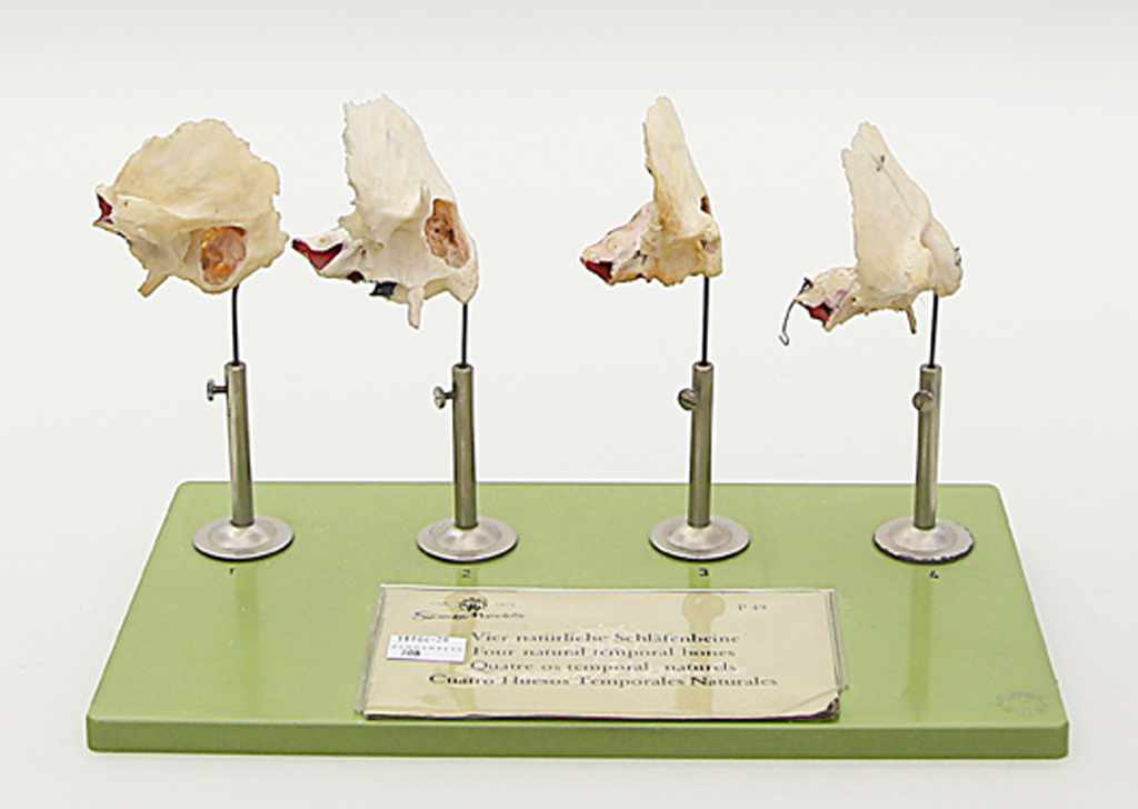 Vier anatomische Präparate,von menschlichen Schläfenbeinen zu Lehrzwecken. Hersteller "Somso",