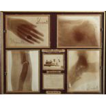 S HUNT Four Early X-Ray Photographs C.1898,