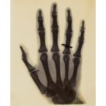 Teall (Sir Jethro) X-ray print of Alvina Bertram C Casey's left hand taken by Teall, 1896 § Galton …