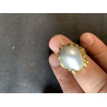 Pearl Jewellery: Ring, yellow metal (tests 18ct.) set with a large South Seas bead nucleated