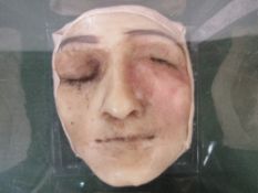 French anatomical wax death mask of a disfigured blind man. Estimate £120-180