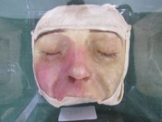 French anatomical wax death mask of a jawless man. Estimate £140-180