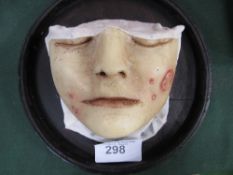 French anatomical wax death mask of a Syphilitic woman on stand. Estimate £180-200