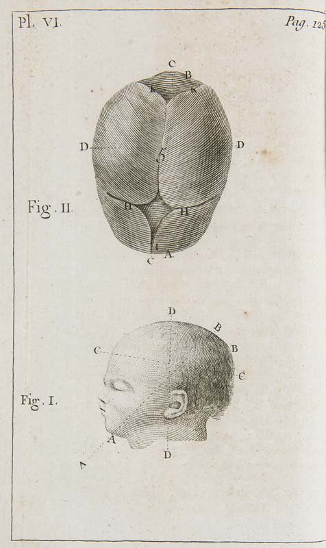 Medizin - - Baudelocque, J. L. Principes sur l'art des accouchemens, par demandes et réponses, en