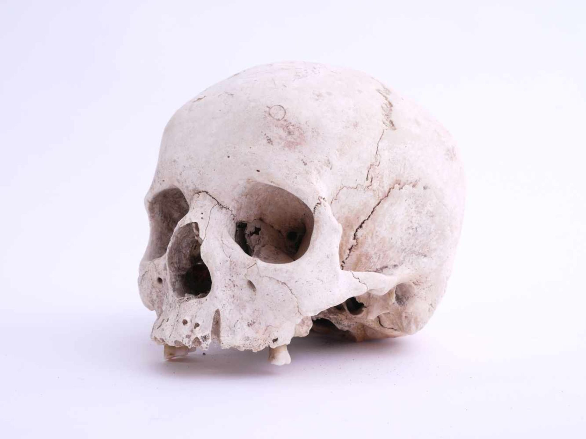Totenschädel Alter unbestimmtKlar sichtbare Schädelnähte, Unterkiefer fehlend. Drei der hinteren