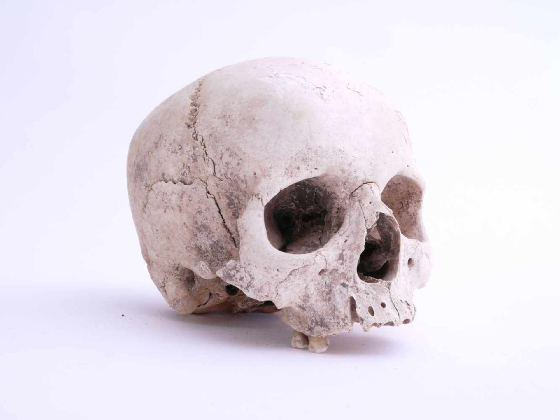 Totenschädel Alter unbestimmtKlar sichtbare Schädelnähte, Unterkiefer fehlend. Drei der hinteren - Bild 3 aus 5