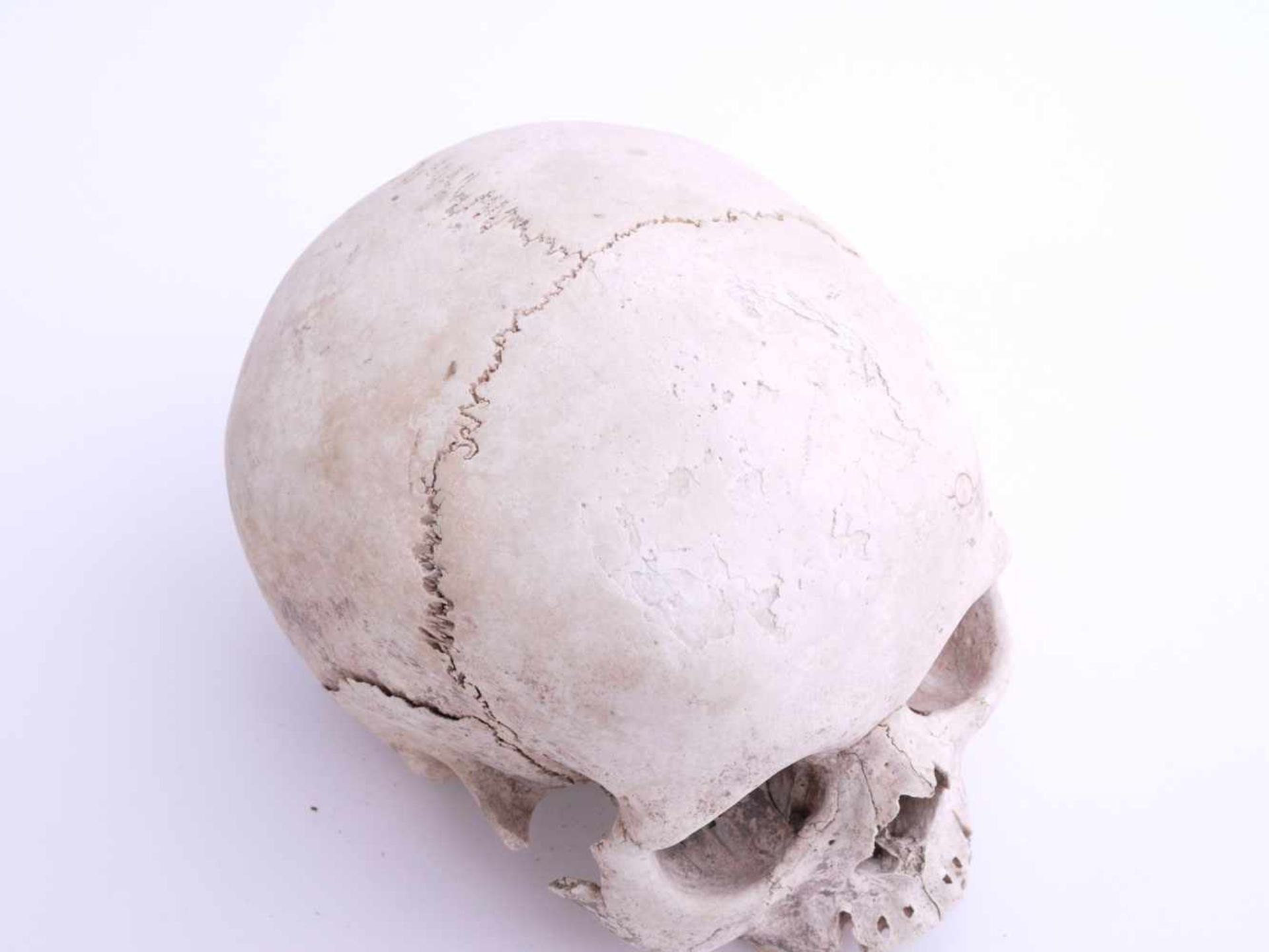 Totenschädel Alter unbestimmtKlar sichtbare Schädelnähte, Unterkiefer fehlend. Drei der hinteren - Bild 4 aus 5