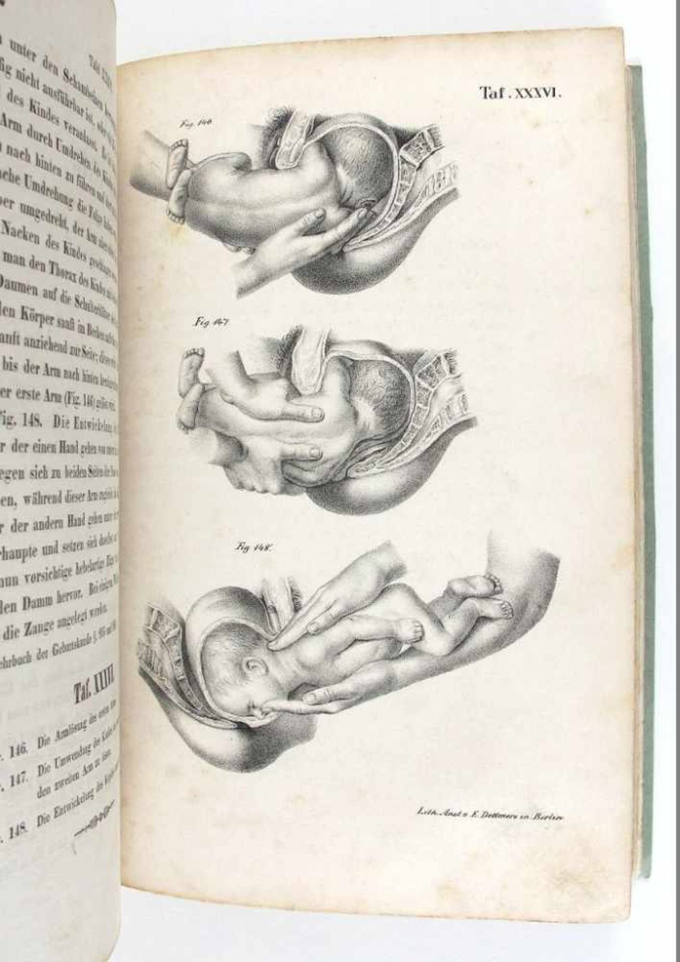 Medizin/Geburtshilfe: Busch, Dr. Dietr(ich) Wilh(elm) Heinr(ich). Atlas geburtshülflicher - Bild 2 aus 3