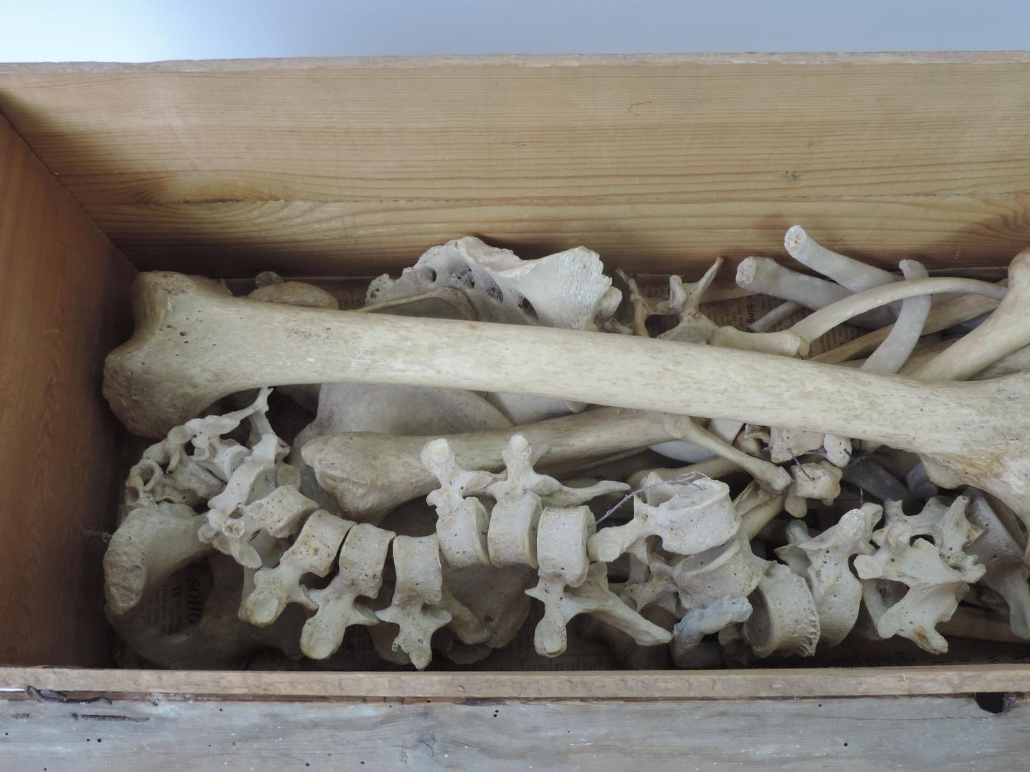 Wooden Box and Contents - Part Human Skeleton - Image 3 of 4