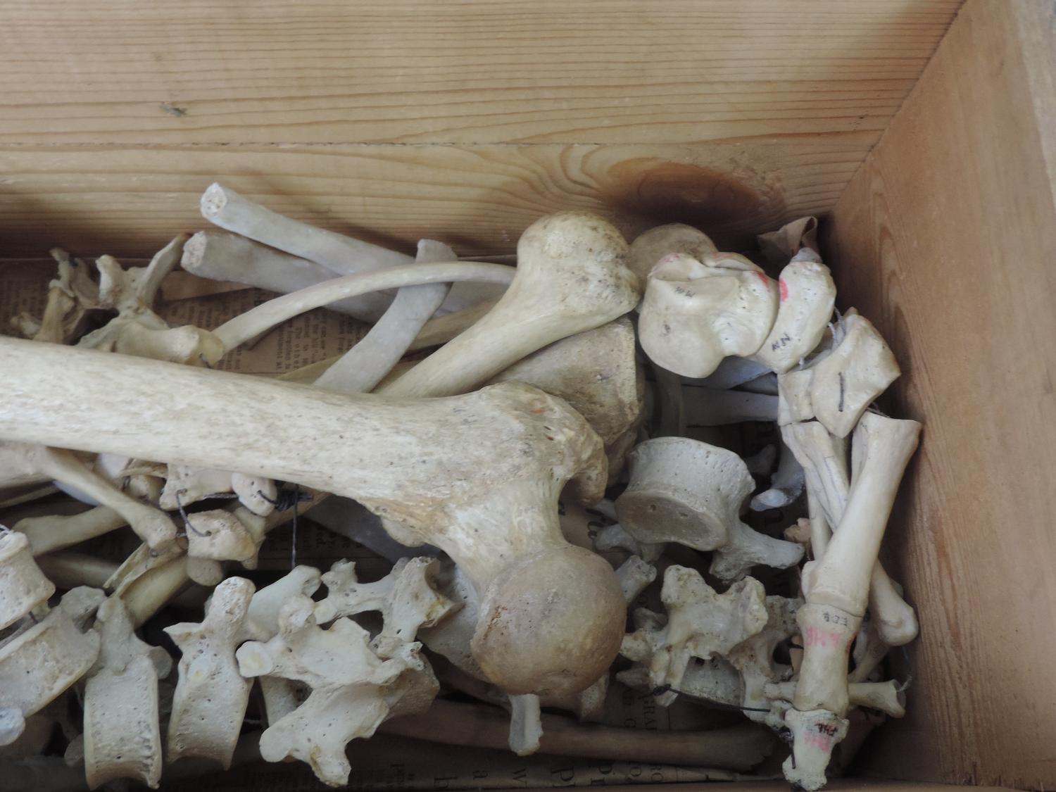 Wooden Box and Contents - Part Human Skeleton - Image 4 of 4