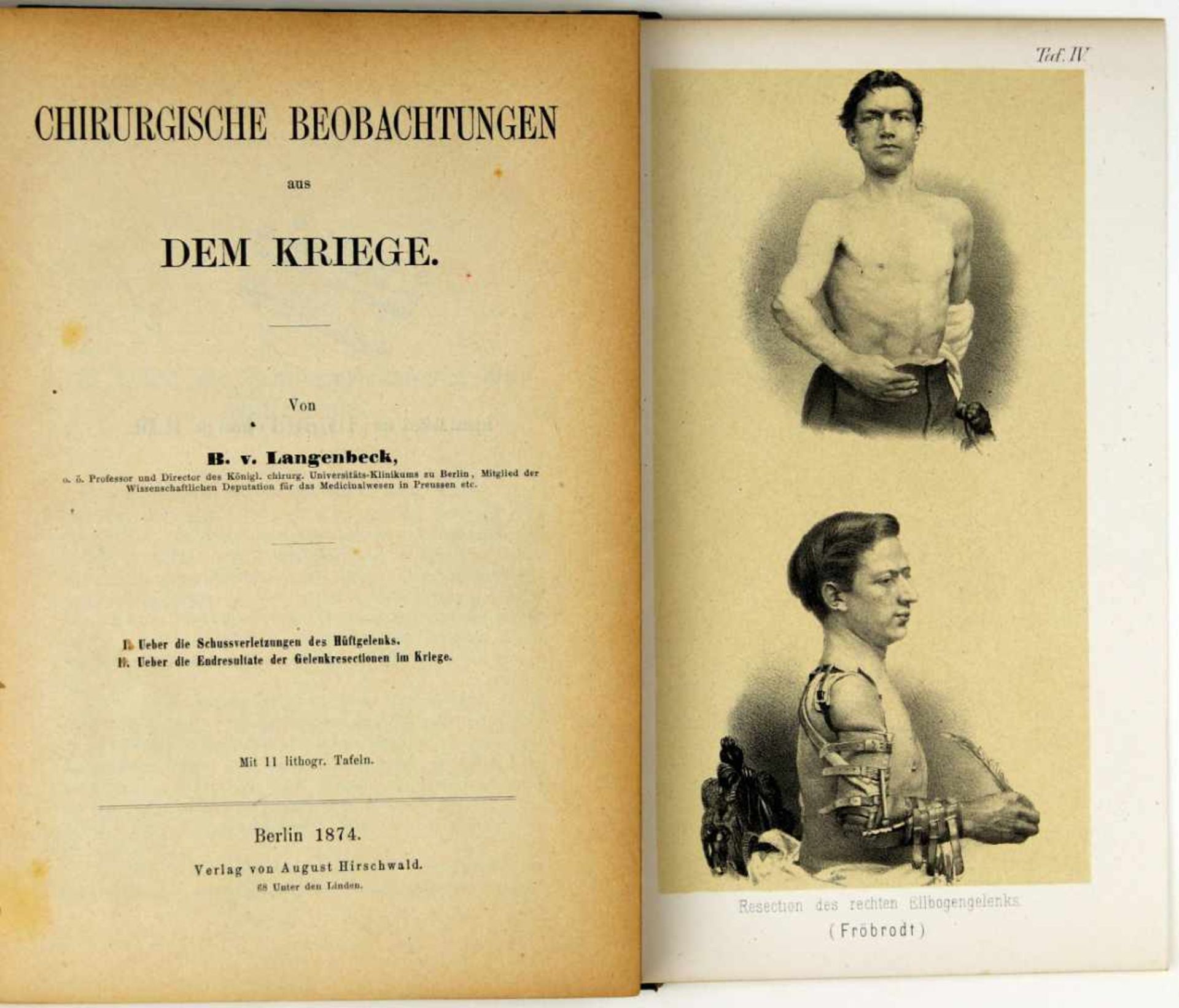 Feldchirurgie. -Langenbeck, Bernhard von:Chirurgische Beobachtungen aus dem Kriege. Berlin, August