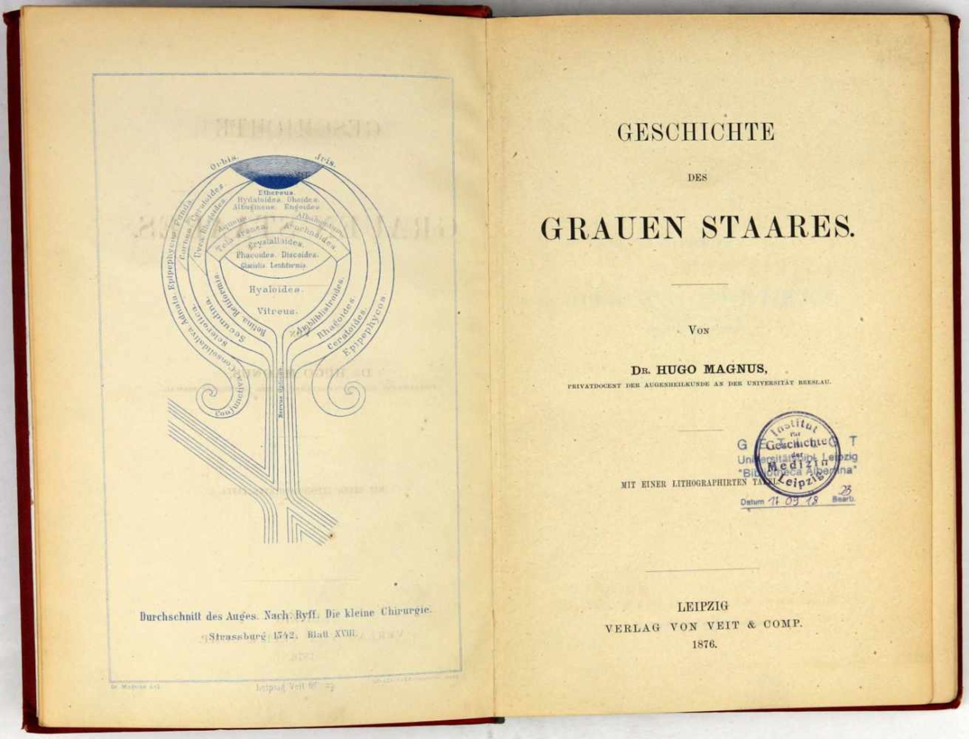 Augenheilkunde. -Magnus, Hugo:Geschichte des Grauen Staares. Leipzig, Veit & Comp. 1876. Mit 1