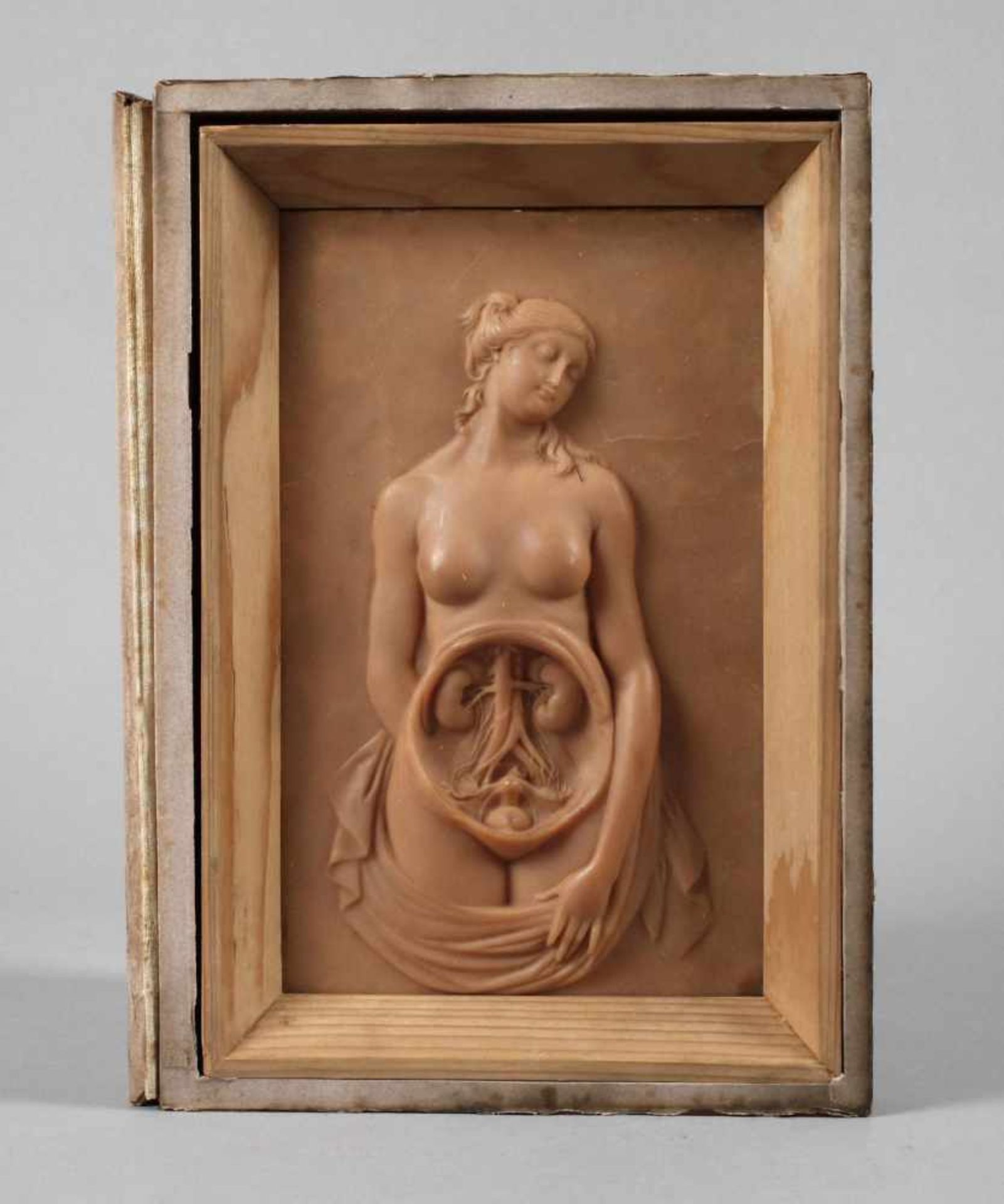 Anatomisches Modellum 1900, Wachsguss, reliefierte Darstellung eines weiblichen Aktes mit geöffneter