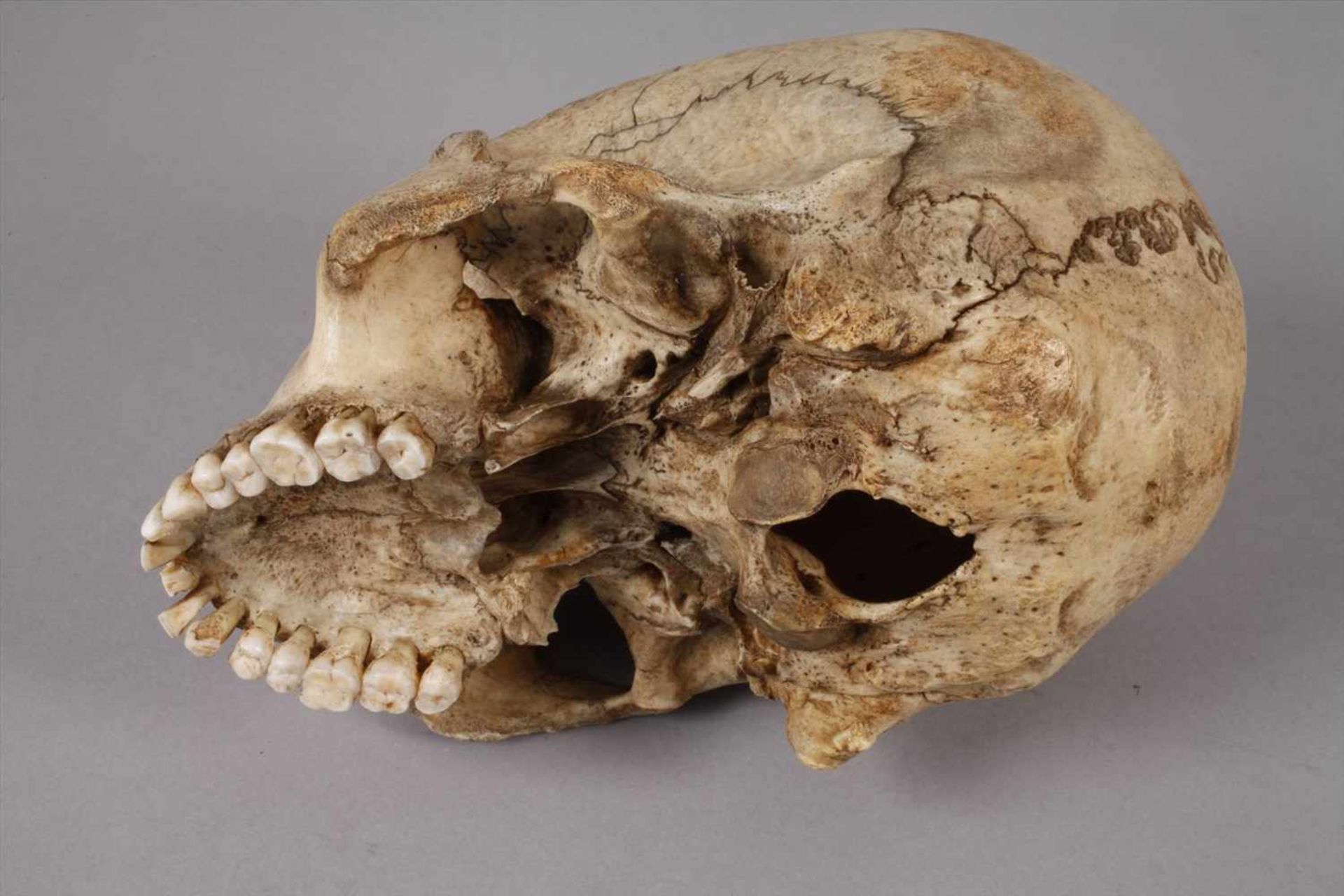 Memento Moriwohl 19. Jh., präparierter menschlicher Schädel, mit Brandmalerei verziert und - Bild 2 aus 3