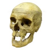 Anatomical teaching aid of a human skull with detached lower jaw and removable cranium,