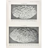 Horsley (Victor). 'Description of the brain of Mr Charles Babbage, FRS', [in:] Philosophical