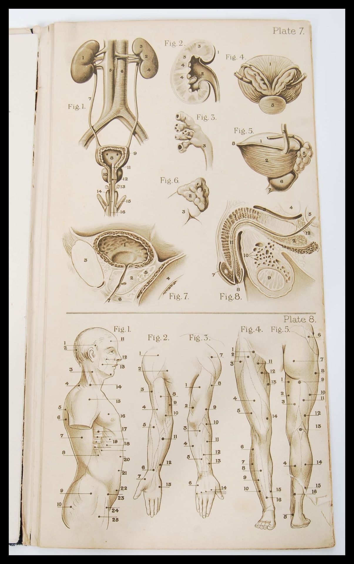 Two early 20th Century Baillieres Female and Male anatomy / anatomical reference books retaining all - Image 3 of 4
