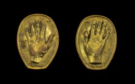 Medical Interest Limited Edition Cast Bronze Impression Of Dr Chris Barnard's Hands On 3 December