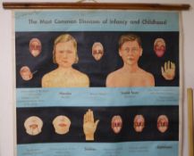 Four vintage medical educational posters
