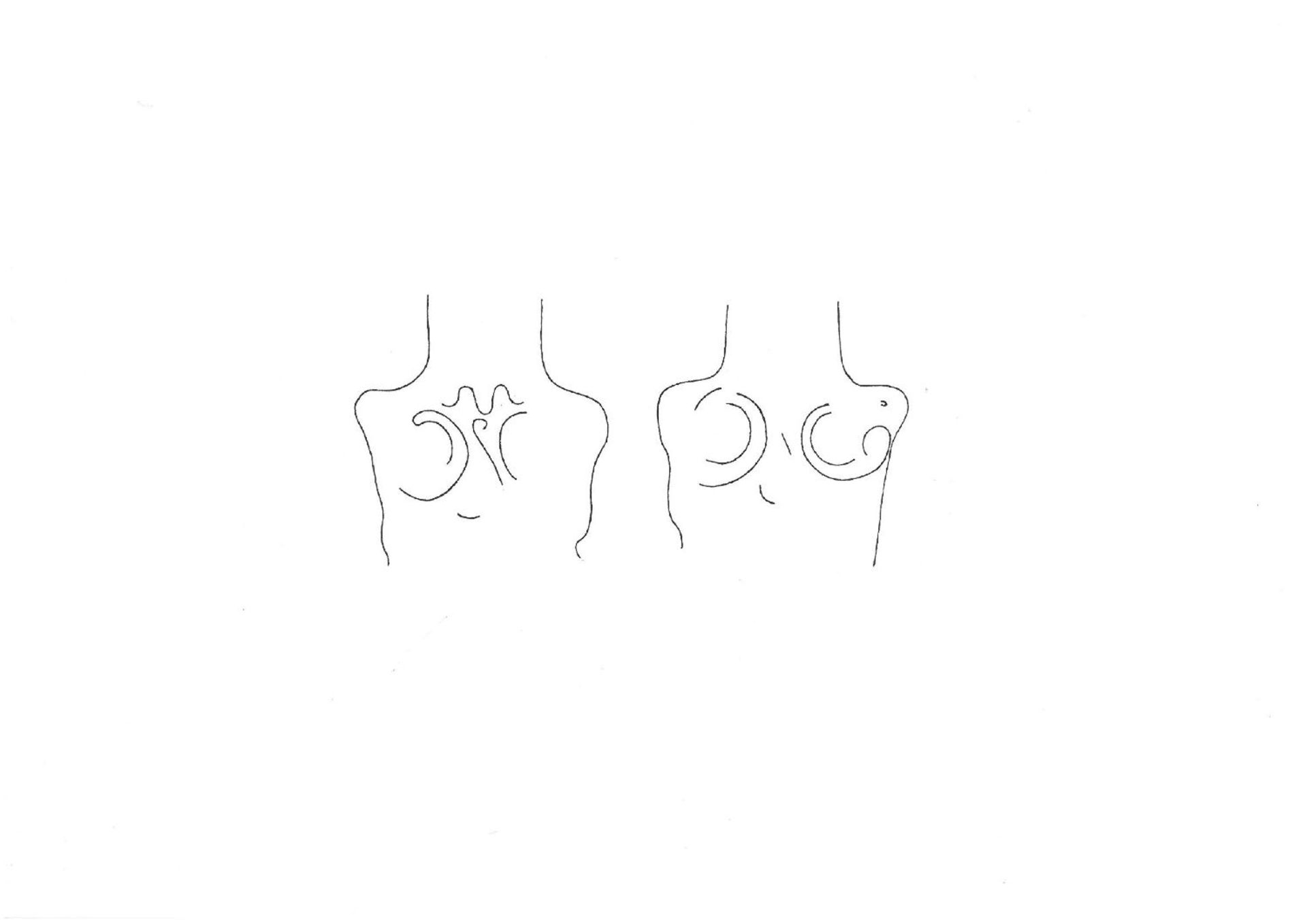 Eisenschwert. Skythisch, 8. - 5. Jh. v. Chr. L gesamt 71,6cm, L Klinge 61,5cm. Direkt unter der - Bild 2 aus 2