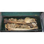 A human skeleton used for research Condition Report: Available upon request