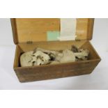 CASED SKELETON - H K LEWIS a disarticulated part skeleton for teaching purposes, in a wooden case